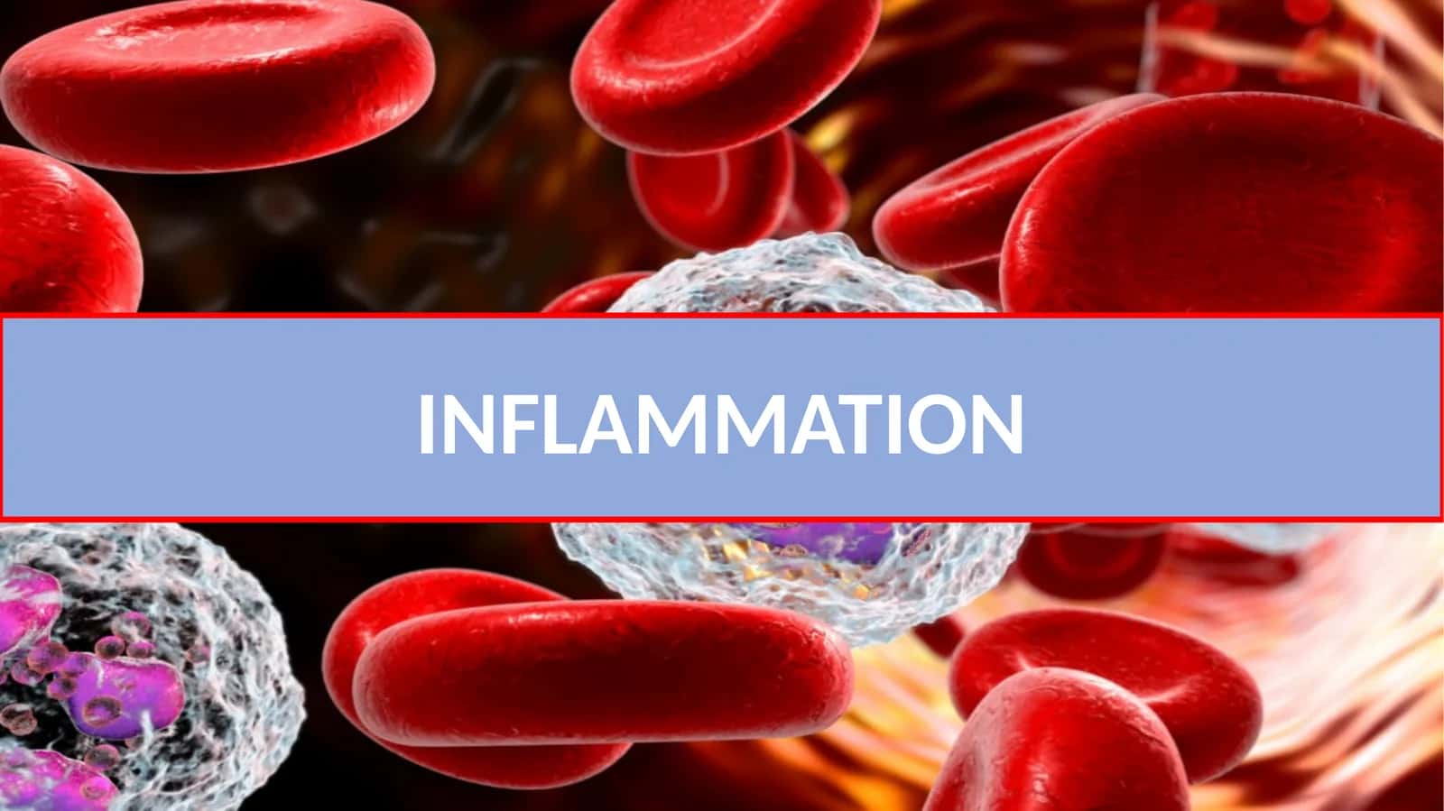 Inflammation 1