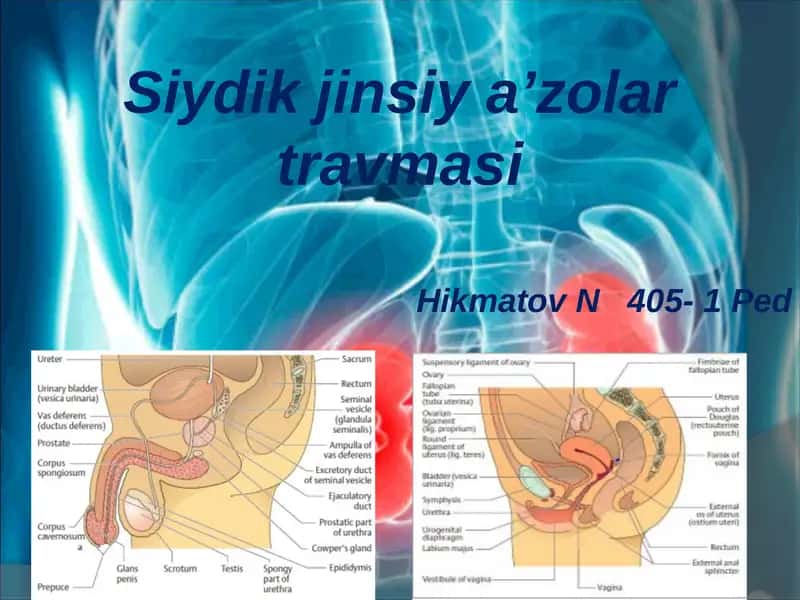 Siydik jinsiy a’zolar travmasi 1
