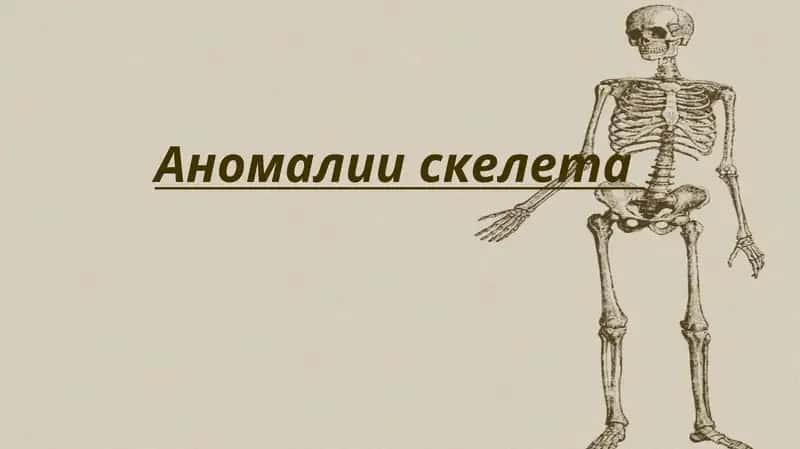 Аномалии скелета 1
