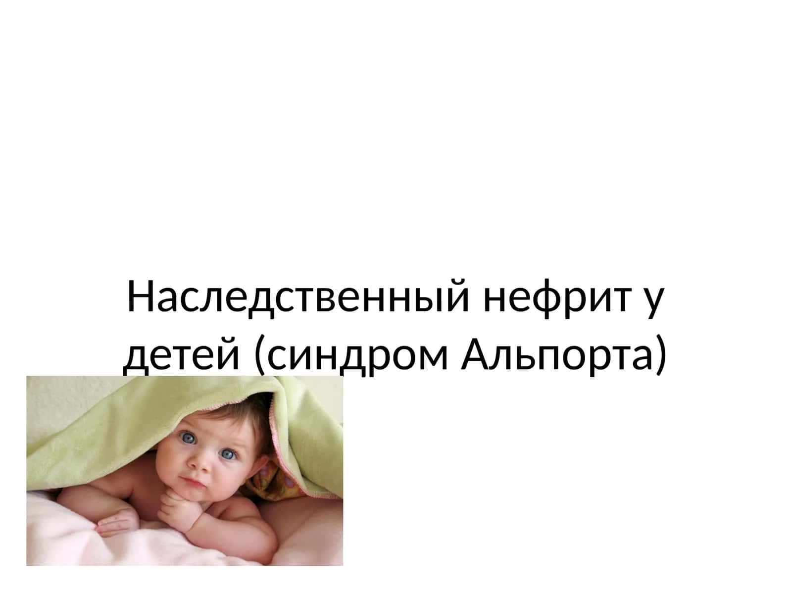 Наследственный нефрит у детей (синдром Альпорта) 1