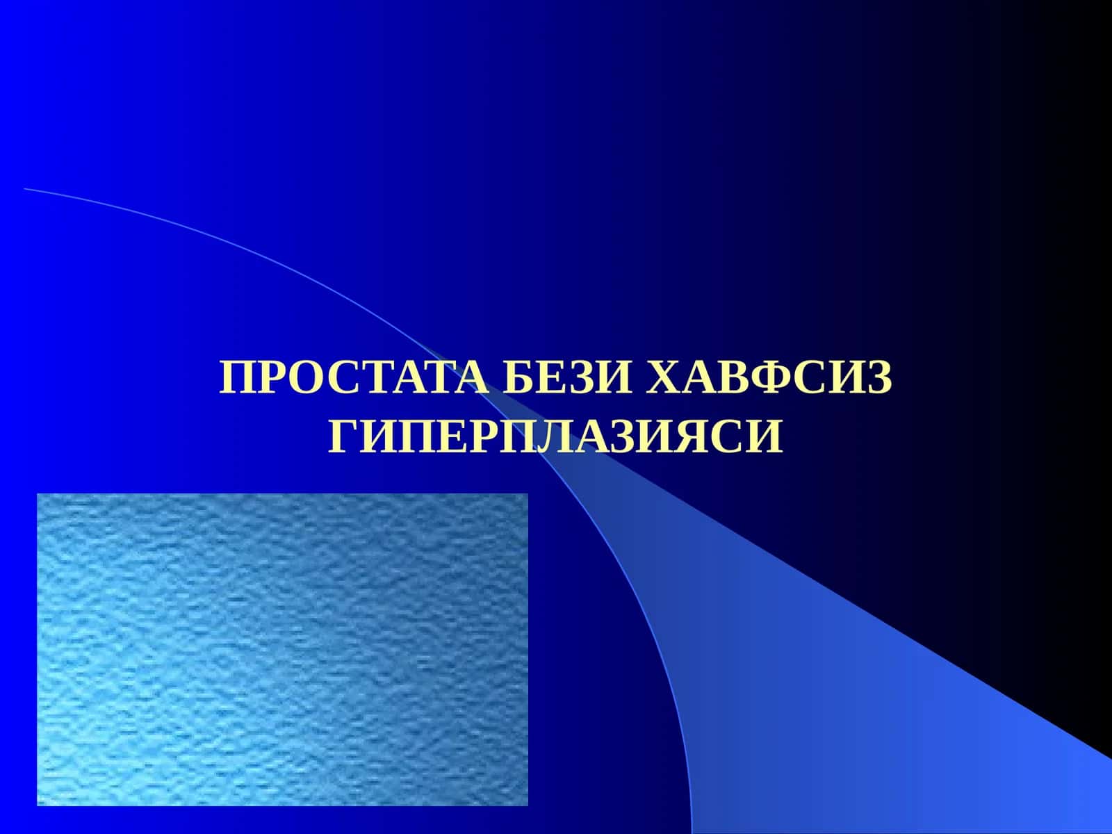 Простата бези хавфсиз гиперплазияси 1