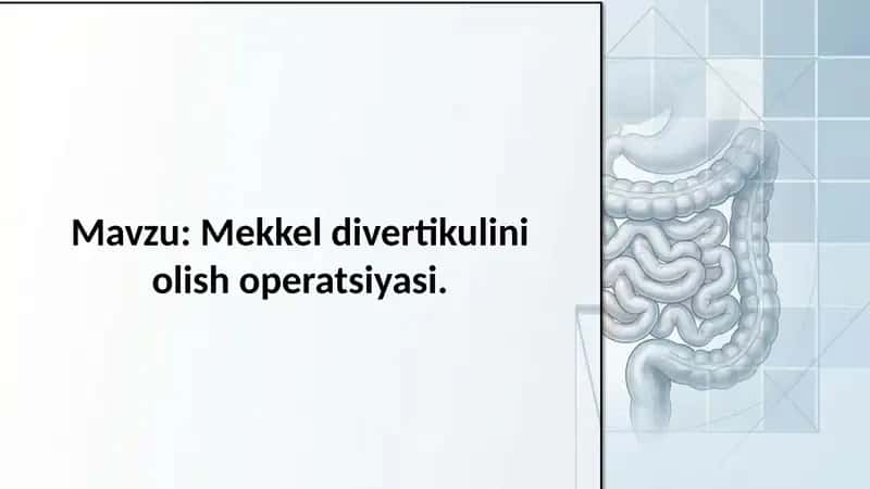 Mekkel divertikulini olish operatsiyasi 1