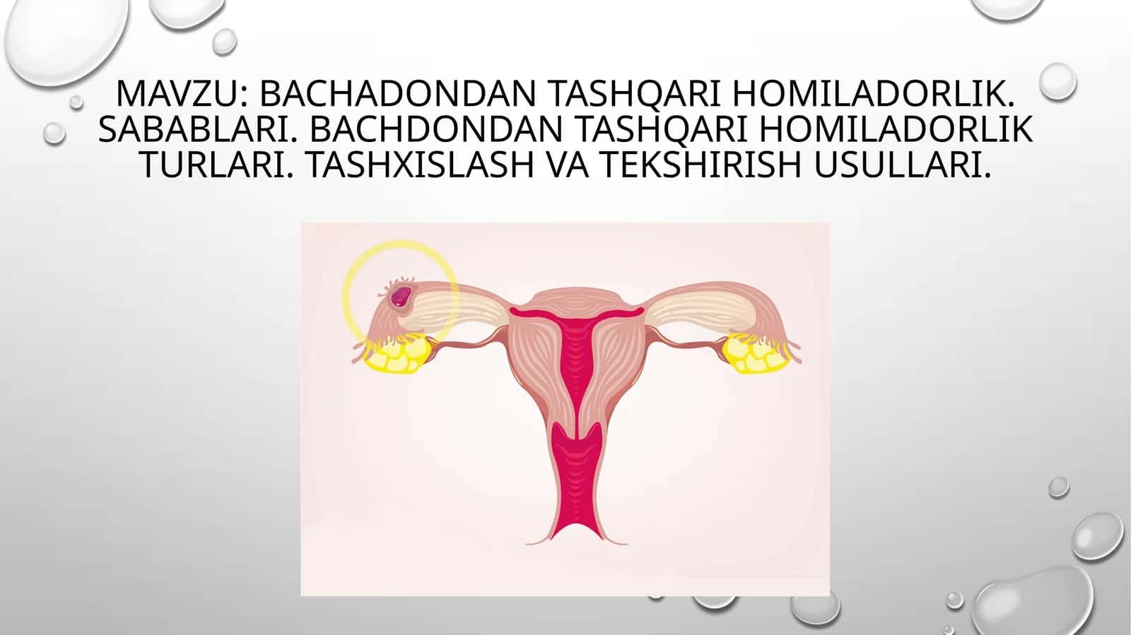 Bachadondan tashqari homiladorlik. Sabablari.Bachdondantashqari homiladorlik turlari.Tashxislashva tekshirish usullari 1
