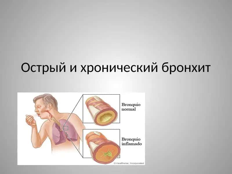 острый и хронический бронхит 1