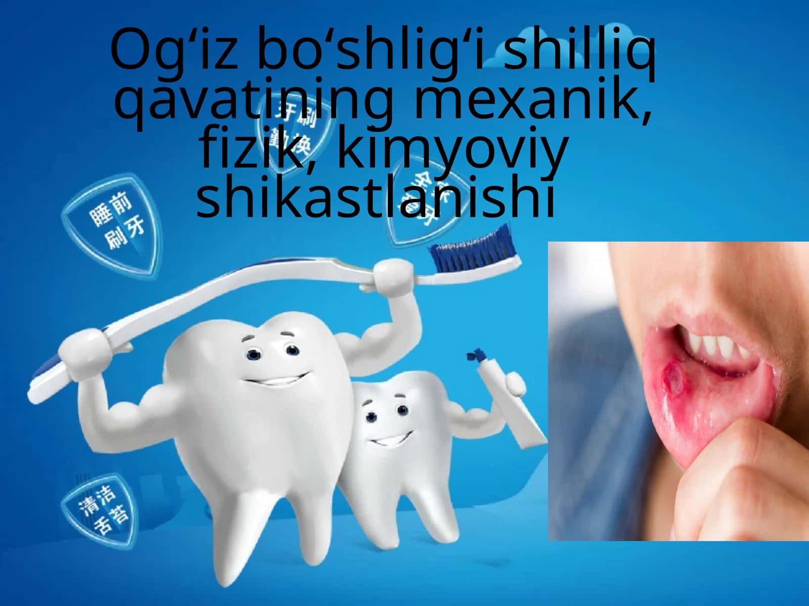 Ogʻiz boʻshligʻi shilliq qavatining mexanik, fizik, kimyoviy shikastlanishi 1