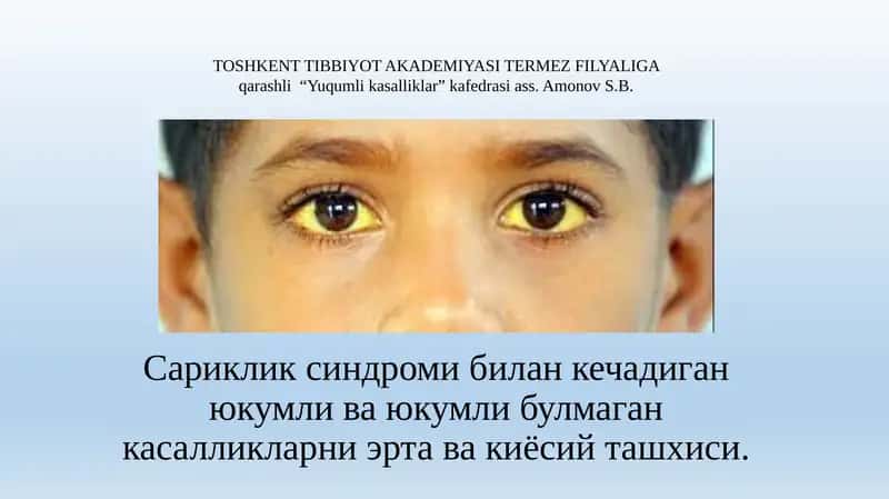 Сариклик синдроми билан кечадиган юкумли ва юкумли булмаган касалликларни ертава киёсий ташхиси 1