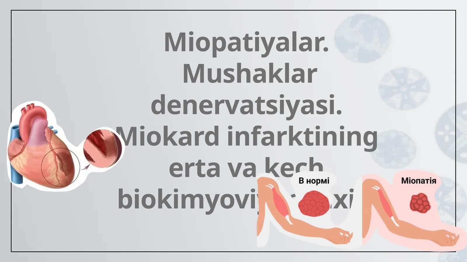 Miopatiyalar.Mushaklar denervatsiyasi. Miokard infarktining erta va kech biokimyoviy tashxisi 1
