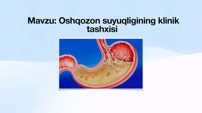 Oshqozon suyuqligining klinik tashxisi 1