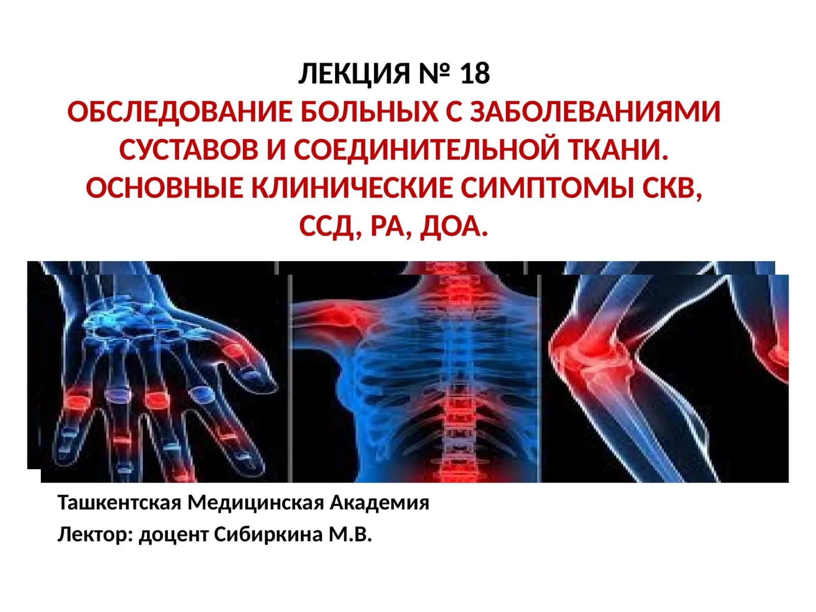ЛЕКЦИЯ № 18ОБСЛЕДОВАНИЕ БОЛЬНЫХ С ЗАБОЛЕВАНИЯМИ СУСТАВОВ И СОЕДИНИТЕЛЬНОЙ ТКАНИ. ОСНОВНЫЕ КЛИНИЧЕСКИЕ СИМПТОМЫ СКВ, ССД, РА, ДОА 1