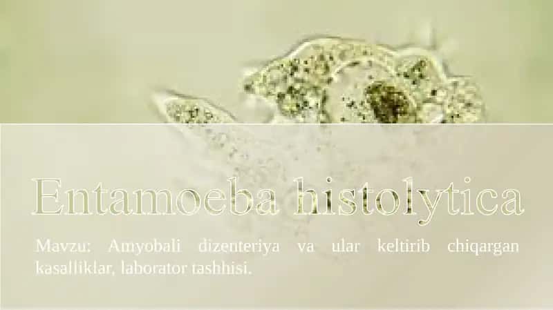 Amyobalidizenteriyavaularkeltiribchiqargankasalliklar,laboratortashhisi 1