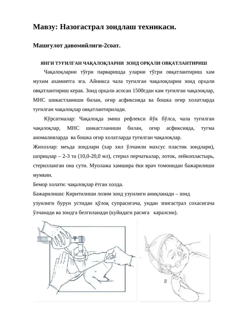 Назогастрал зондлаш техникаси 1