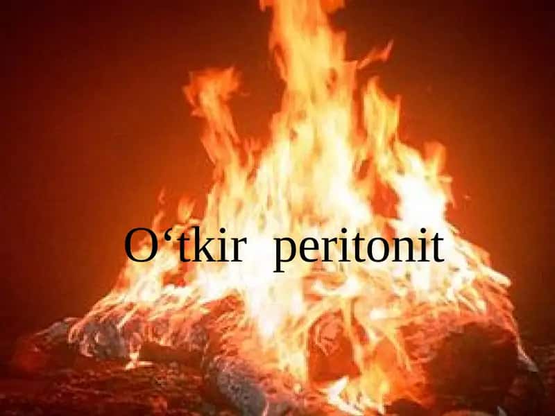 O‘tkir  peritonit 1