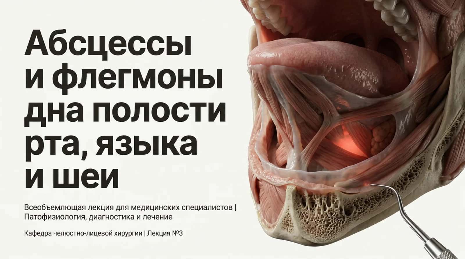 Абсцессы и флегмоны дна нолости рта языка и шеи 1