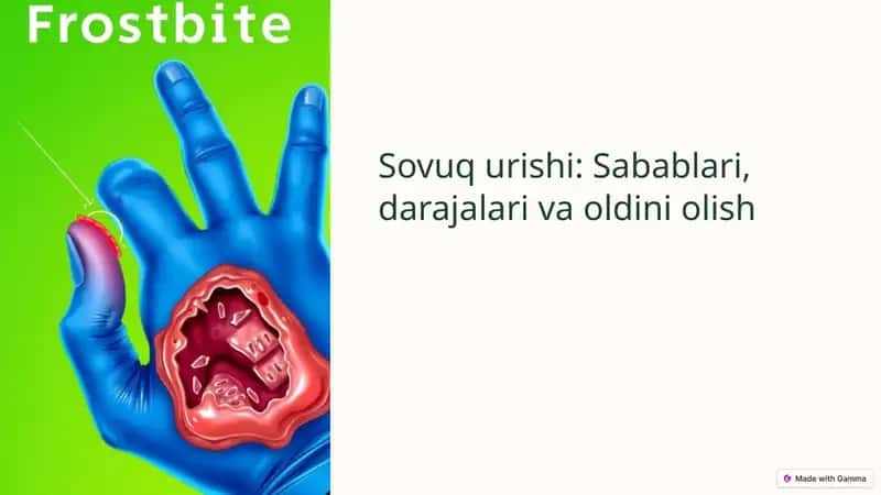 Sovuq urishi 1