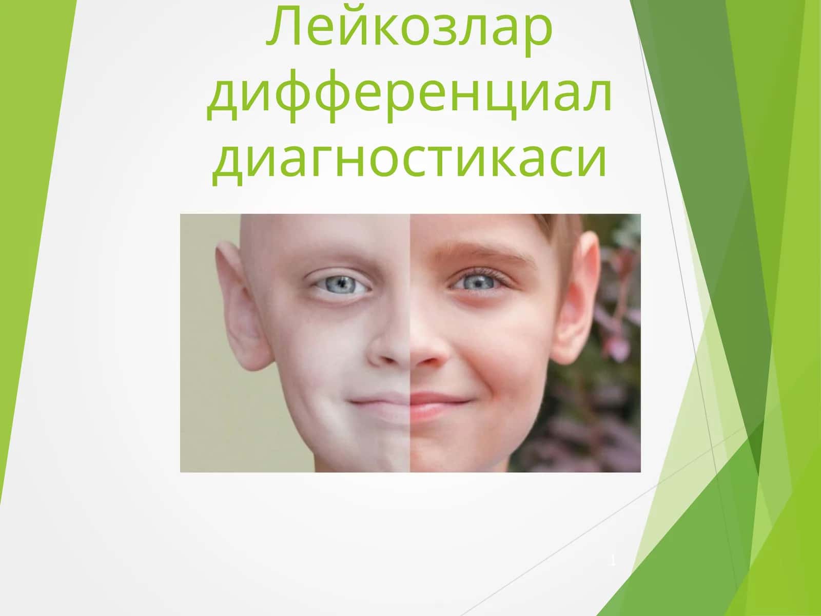 Лейкозлар дифференциал диагностикаси 1