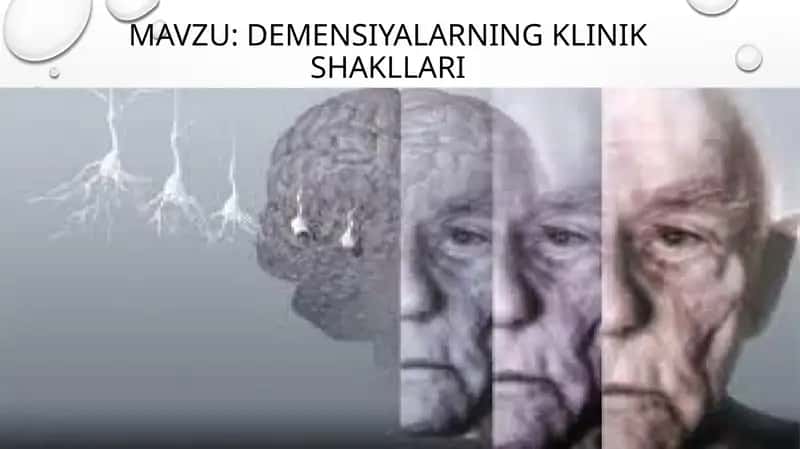 Demensiyalarning klinik shakllari 1