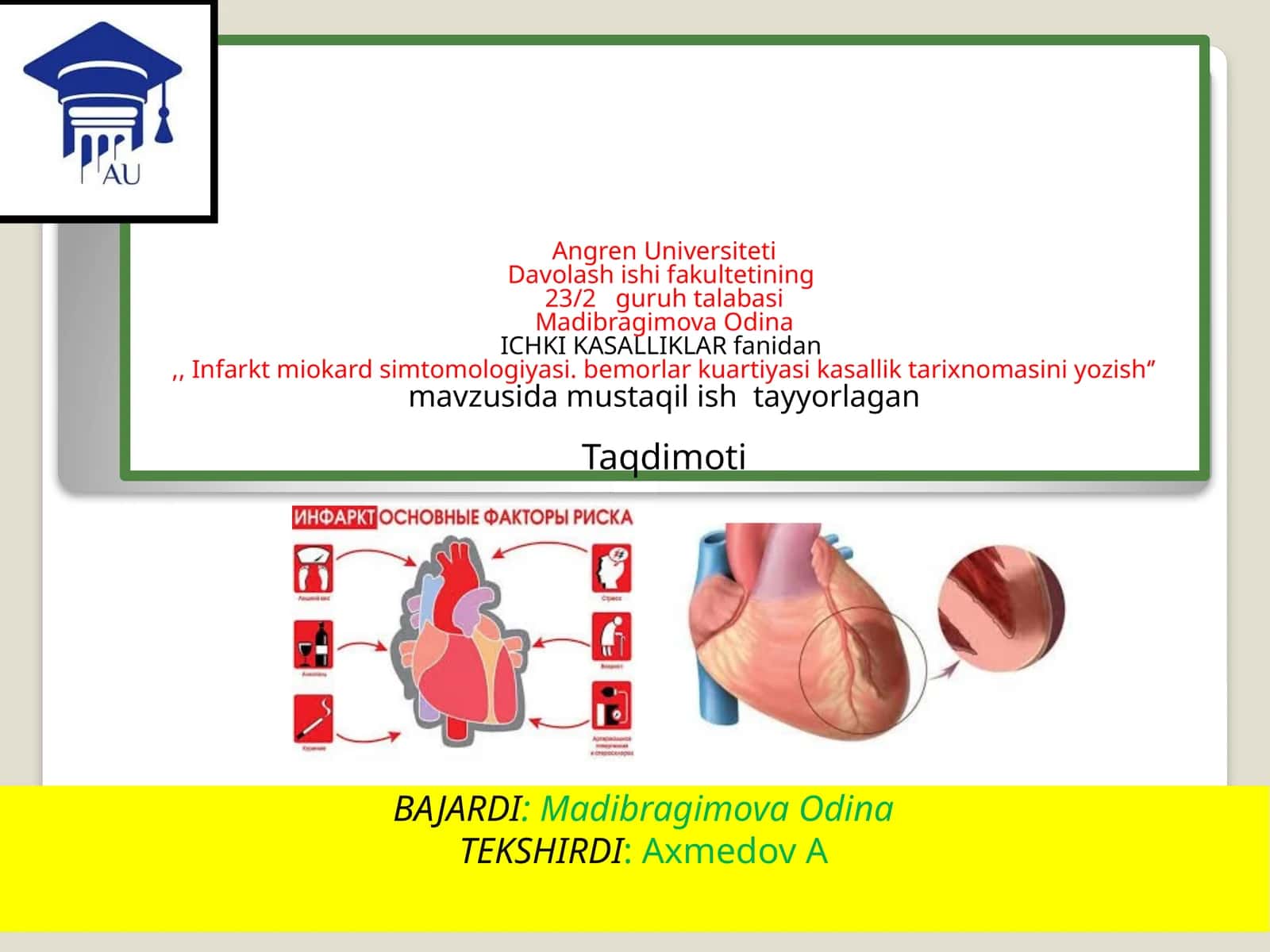 Infarkt miokard simtomologiyasi 1