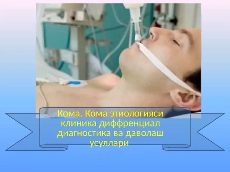 Кома этиологияси клиника диффренциал диагностика ва даволаш усуллари 1