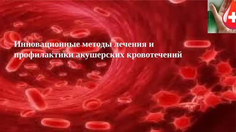 Инновационные методы лечения и профилактики акушерских кровотечений 1