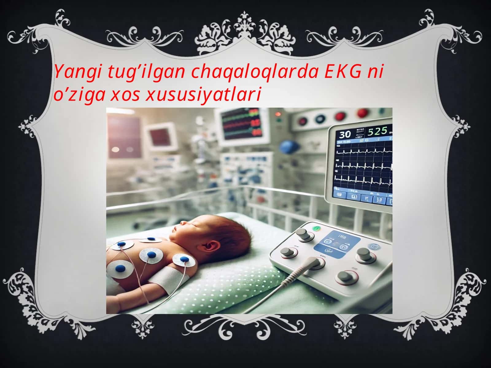 Yangi tug’ilgan chaqaloqlarda EKGni o’ziga xos xususiyatlari 1