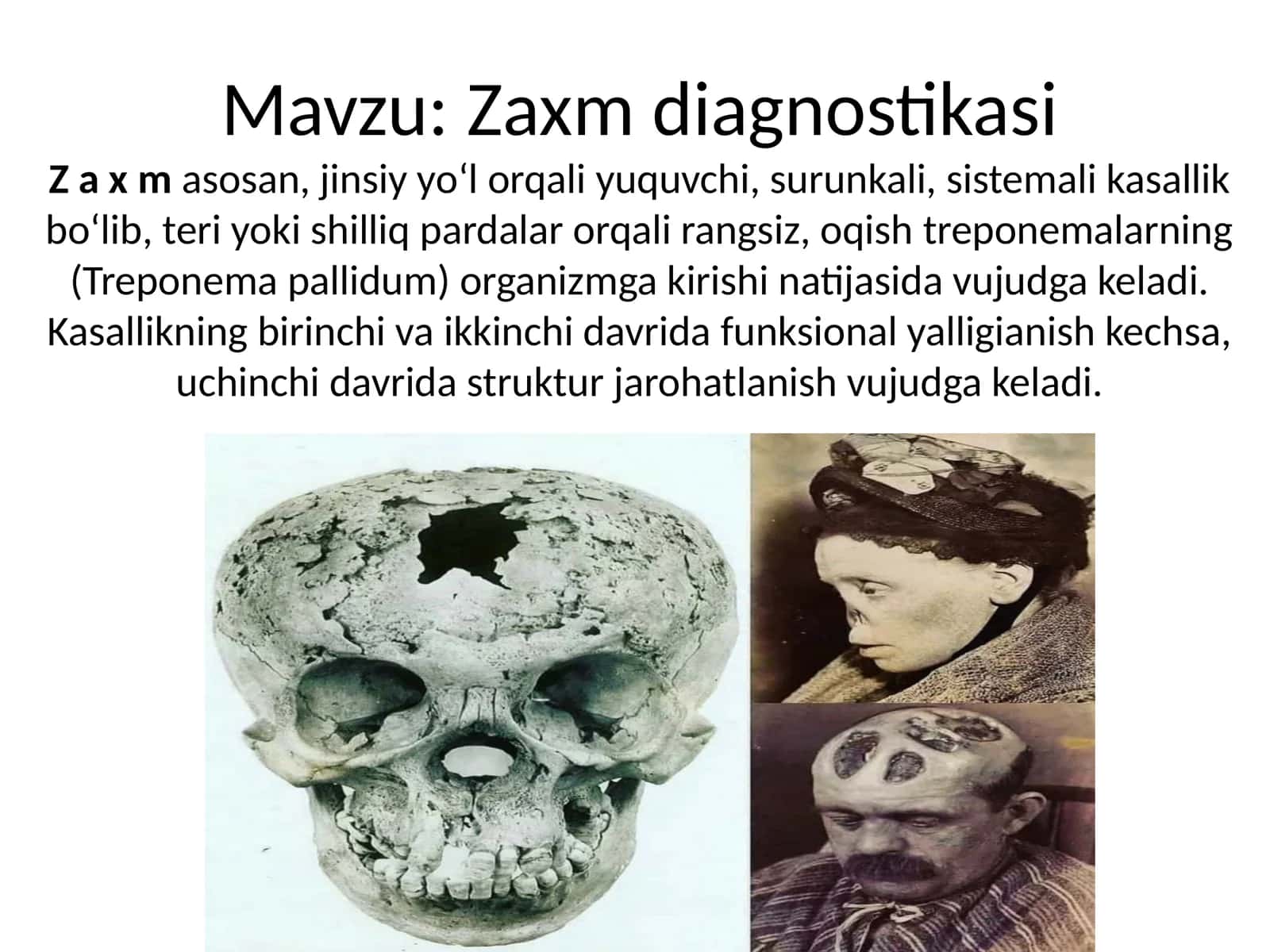 Zaxm diagnostikasi 1