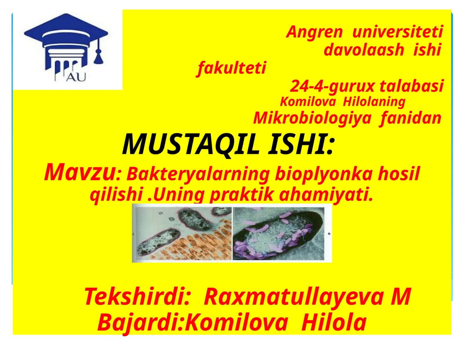 Angren universitetida volaashishi fakulteti 24-4-gurux talabasi Komilova Hilolaning Mikrobiologiya fanidan 1