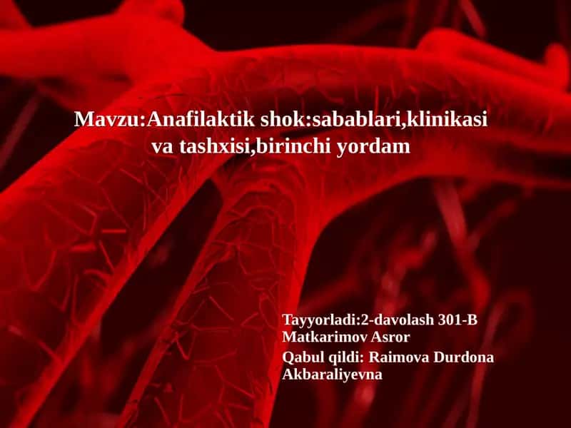 Anafilaktik shok 1