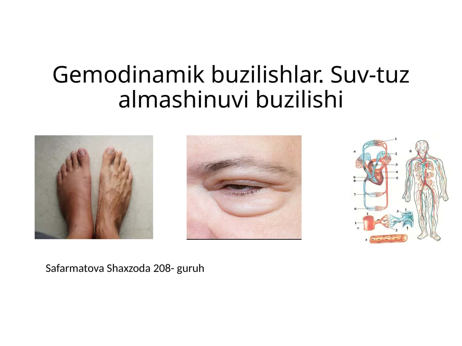 Gemodinamik buzilishlar 1