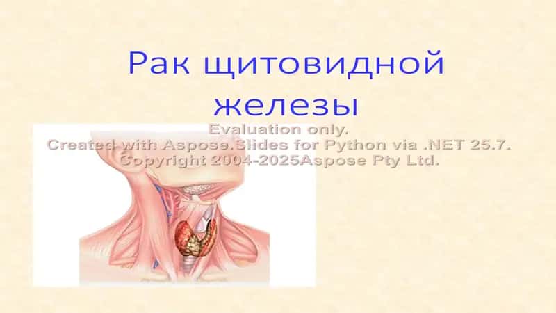 Рак щитовидной железы 1