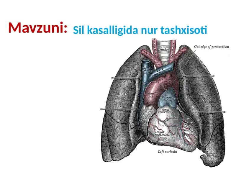 Sil kasalligida nur tashxisoti 1