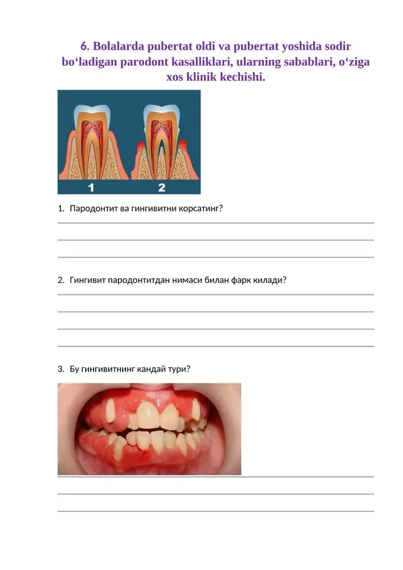 Bolalarda pubertat oldi va pubertat yoshida sodir bo‘ladigan parodont kasalliklari, ularning sabablari, o‘ziga xos klinik kechishi 1