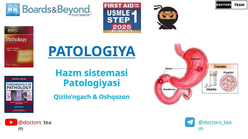 PATOLOGIYA Hazmsistemasi Patologiyasi 1