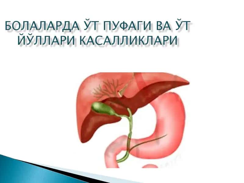 Холецистит 1