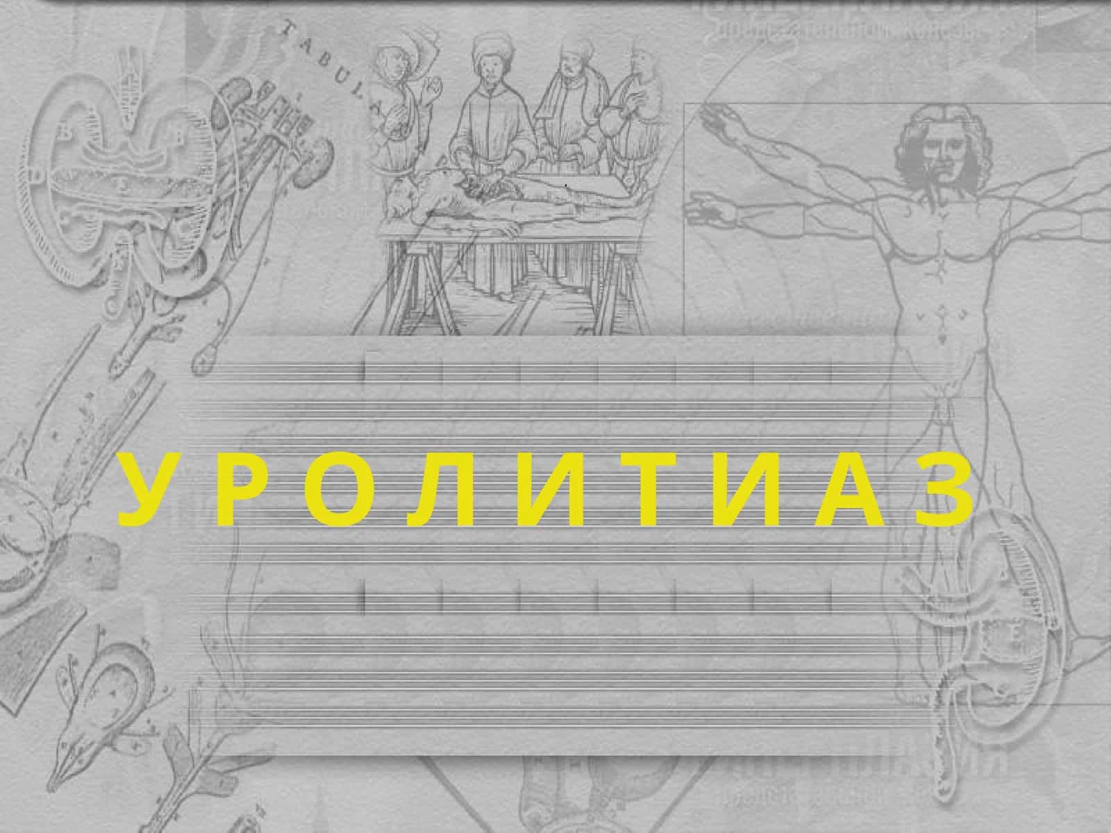 Мочекаменная болезнь (МКБ) 1