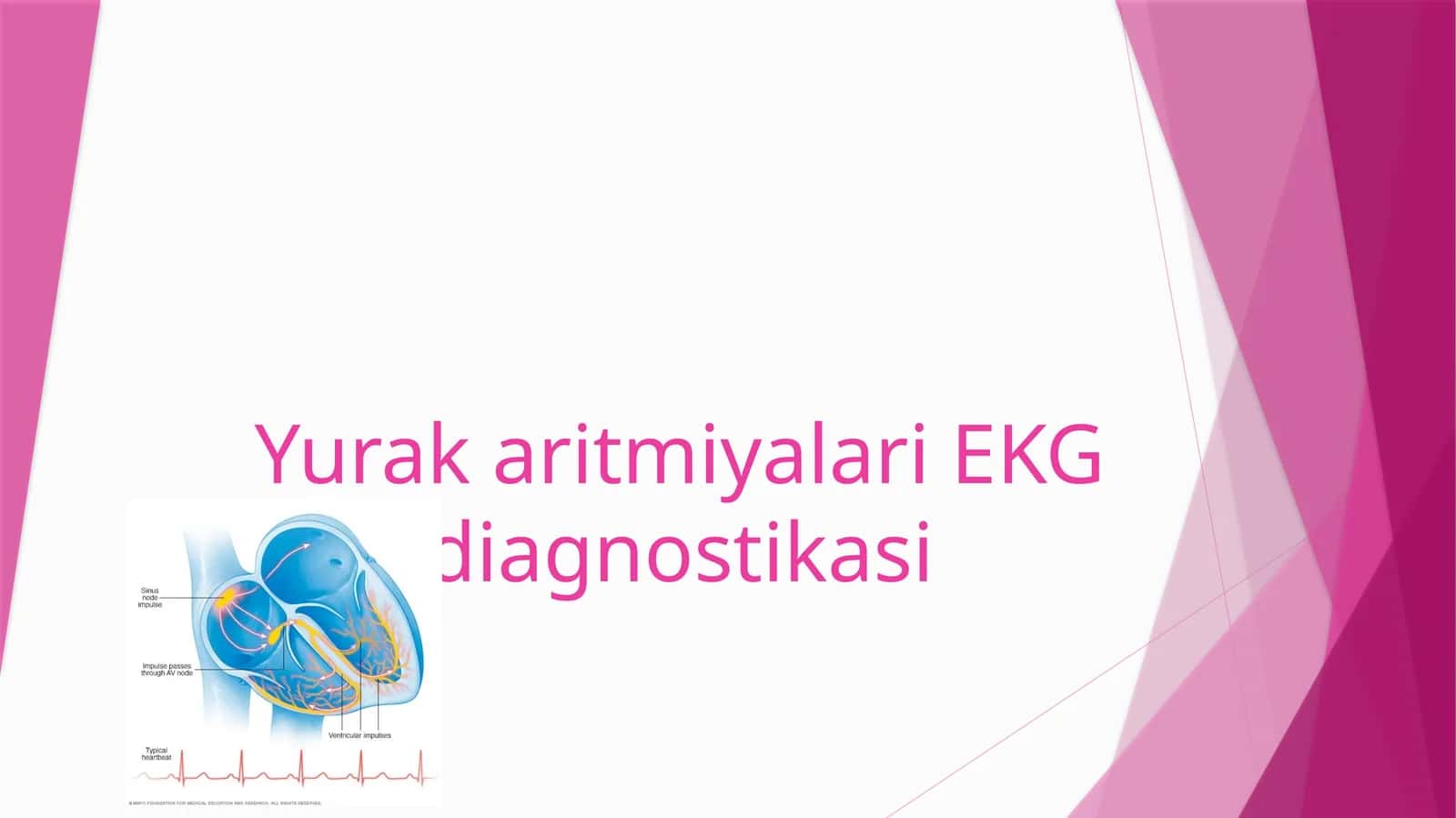 YurakaritmiyalariEKG diagnostikasi 1