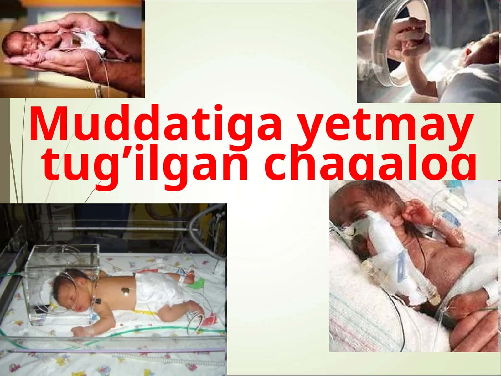 Muddatigayetmay tug’ilgan chaqaloq 1
