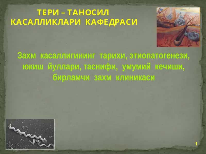 Таносил касалликлари 1