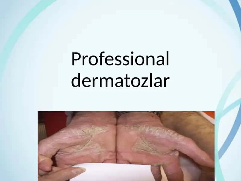Professional dermatozlar 1