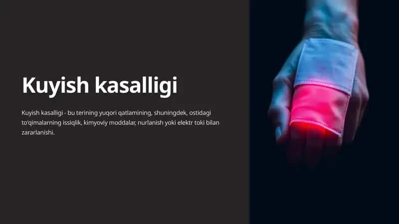 Kuyish kasalligi 1