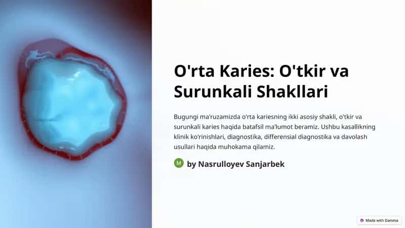 O'rta Karies: O'tkir va Surunkali Shakllari 1