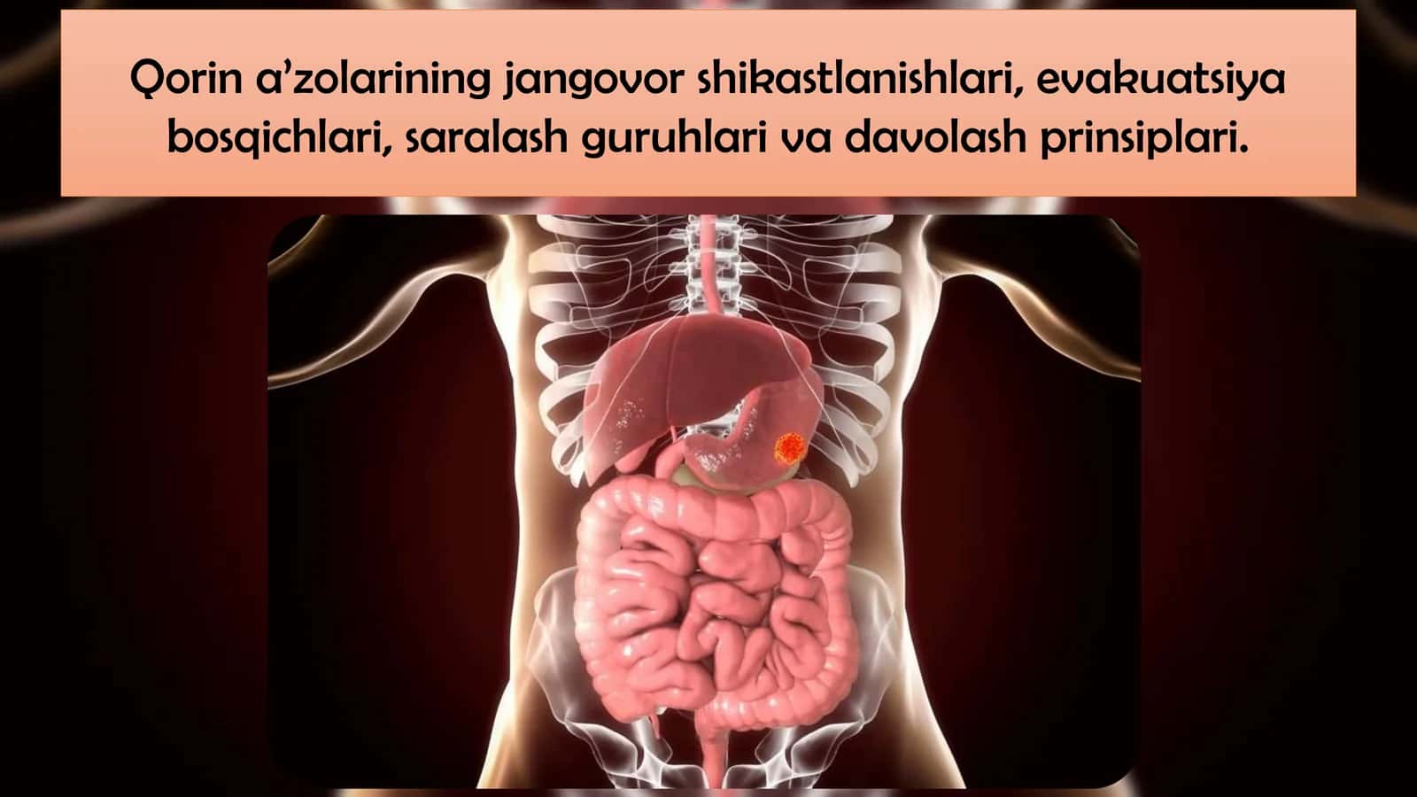 Qorin a’zolarining jangovor shikastlanishlari, evakuatsiya bosqichlari, saralash guruhlari va davolash prinsiplari 1
