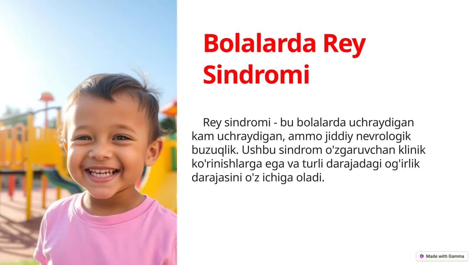 Bolalarda Rey Sindromi 1
