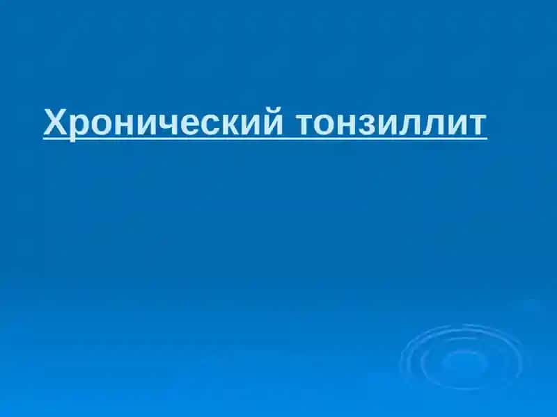 Хронический тонзиллит
