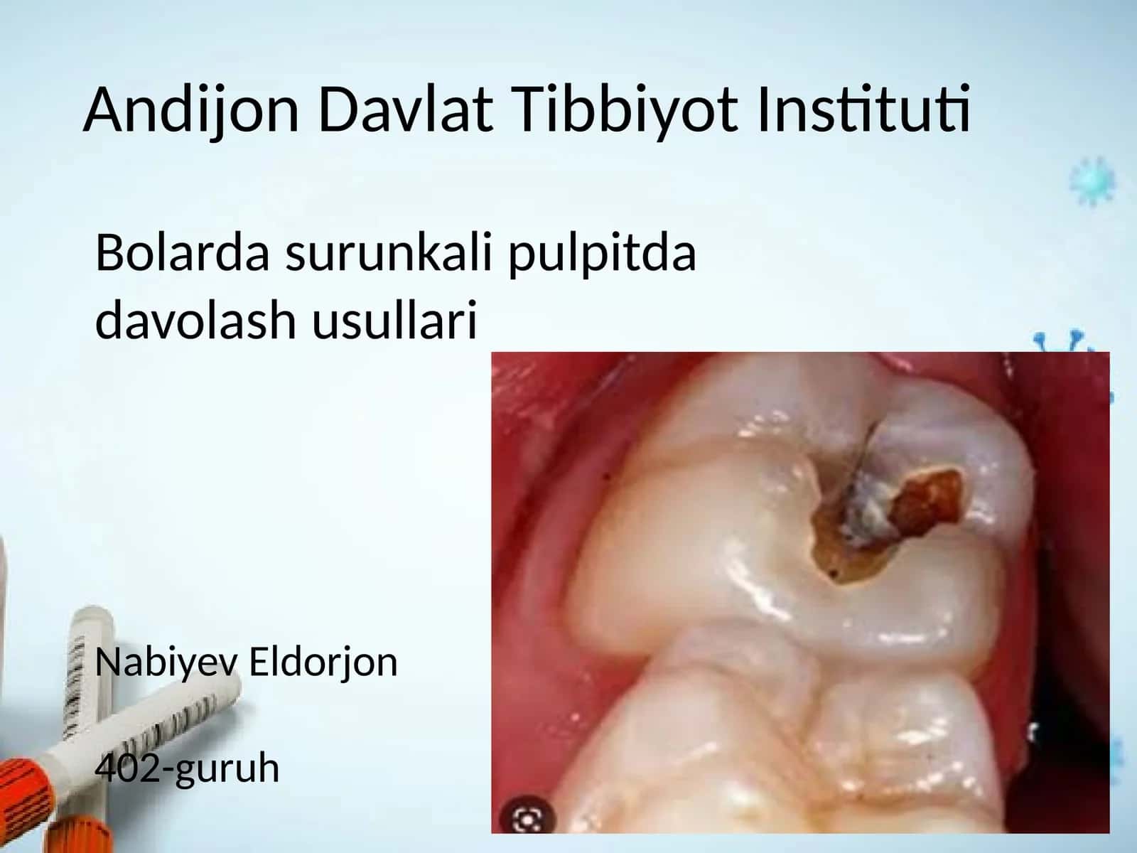 Bolarda surunkali pulpitda davolash usullari 1