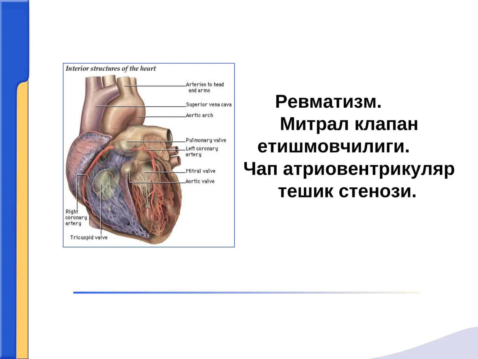 Ревматизм.Митрал клапан етишмовчилиги. Чап атриовентрикуляр тешик стенози 1