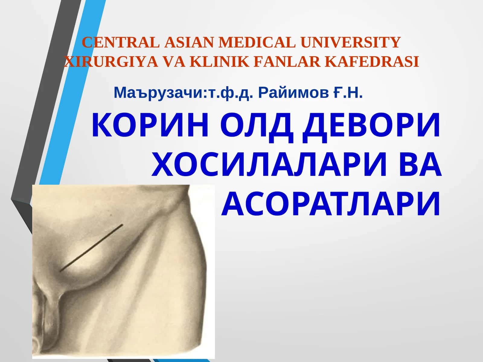 КОРИН ОЛД ДЕВОРИ ХОСИЛАЛАРИ ВА ЧУРРА АСОРАТЛАРИ 1