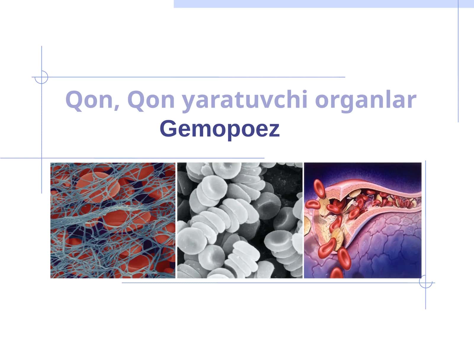 Gemopoez 1