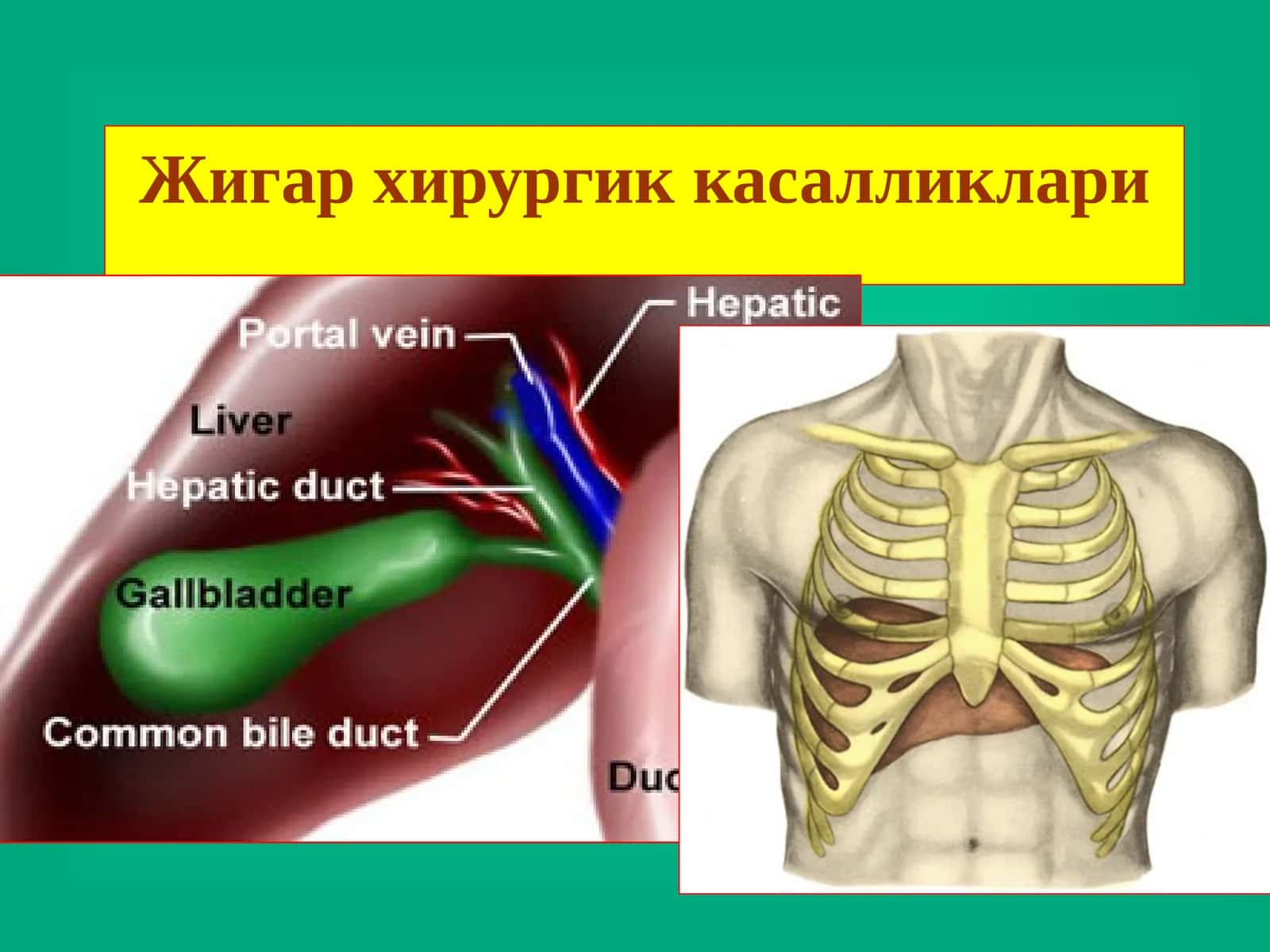 Жигар хирургик касалликлари 1
