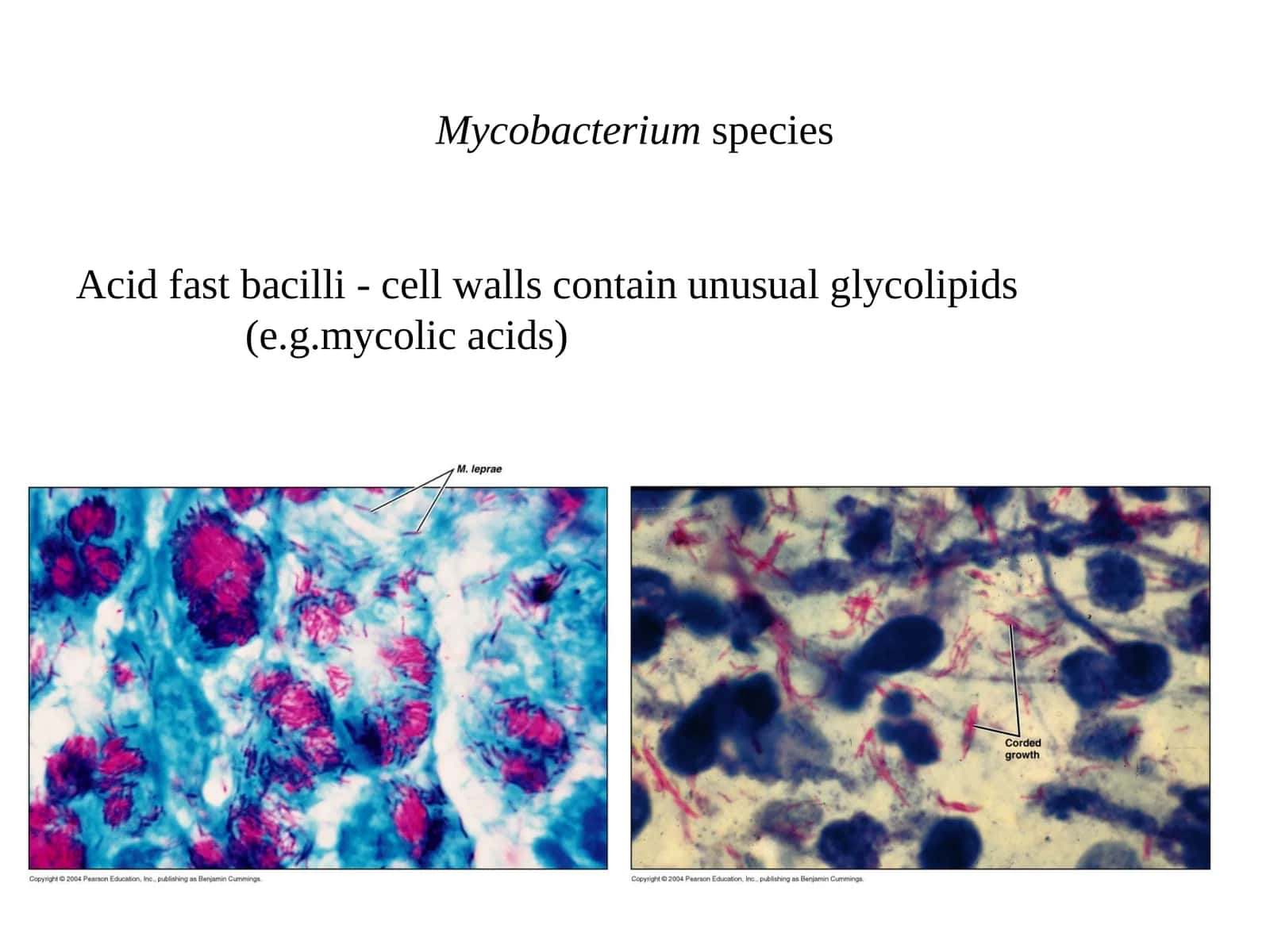 Mycobacterium species 1