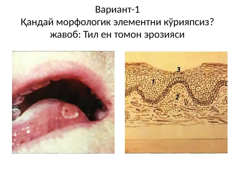 Расмдани маник ўрияпсиз 1